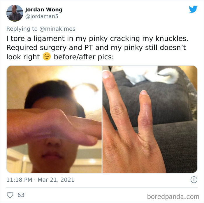 People-Share-Stupidest-Injury