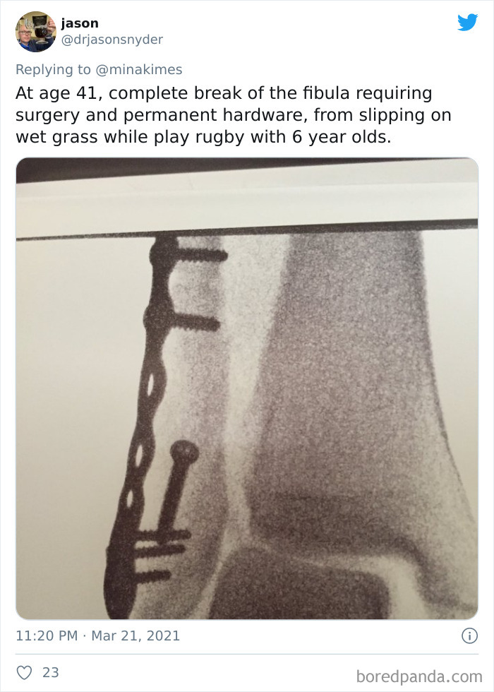 People-Share-Stupidest-Injury