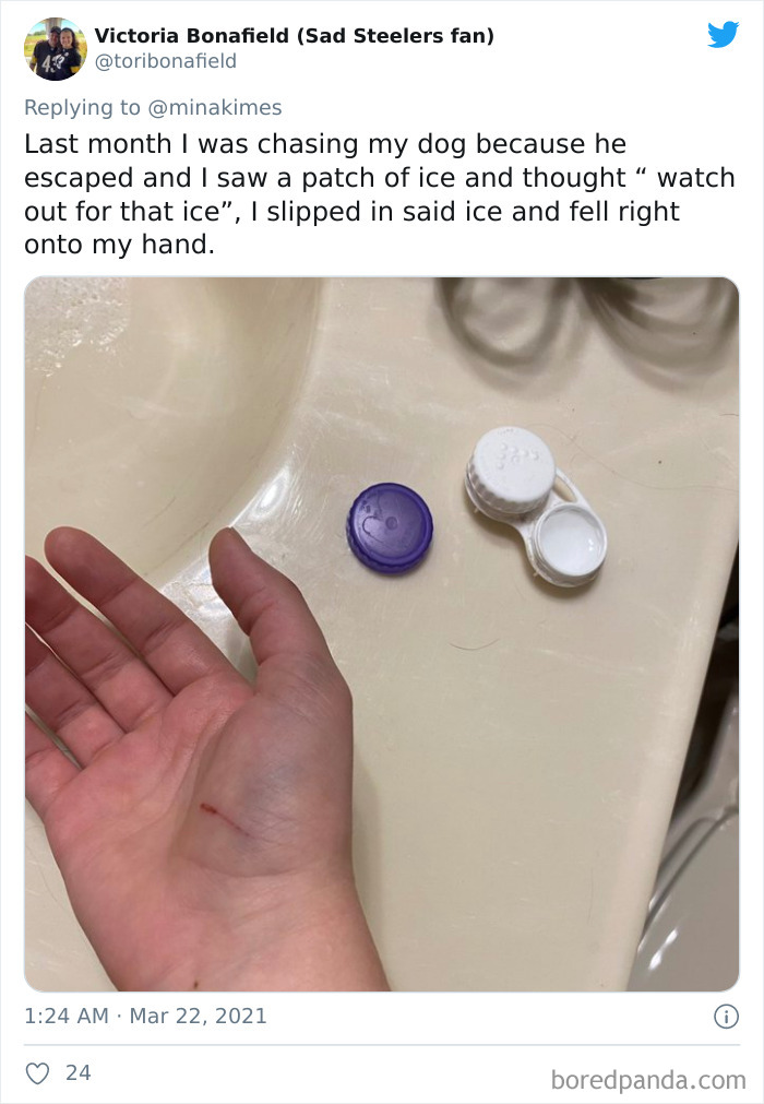 People-Share-Stupidest-Injury