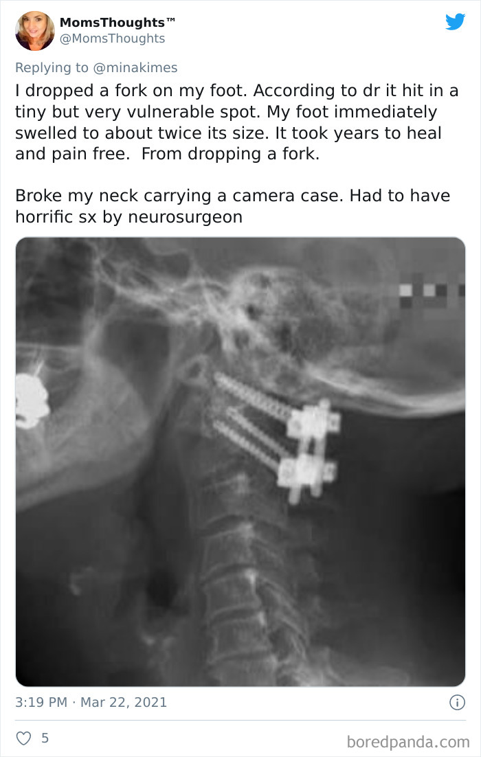 People-Share-Stupidest-Injury