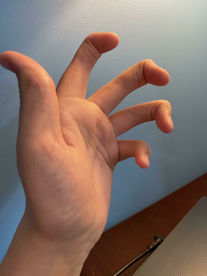 None Of My Fingers Have A Middle Joint