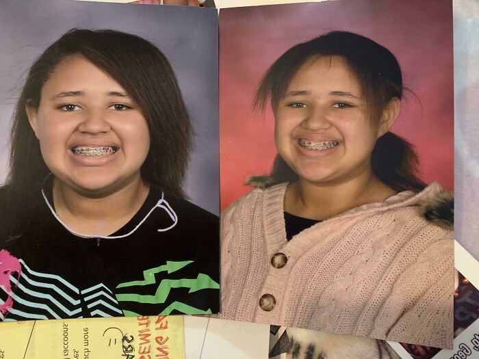 My Mom Insisted I Show Off My Braces. I Think She Was Hoping For Better Results