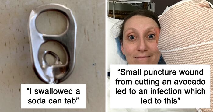 30 Times People Injured Themselves In Dumb Ways And Just Had To Warn Others