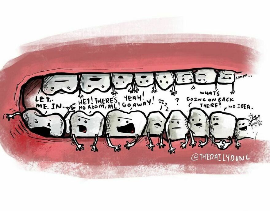 I May Have To Get Mine Taken Out At Some Point. Who Here Has Gone Through It? Tell Me Your Words Of “Wisdom” In The Comments! 🦷 #thedailydunc