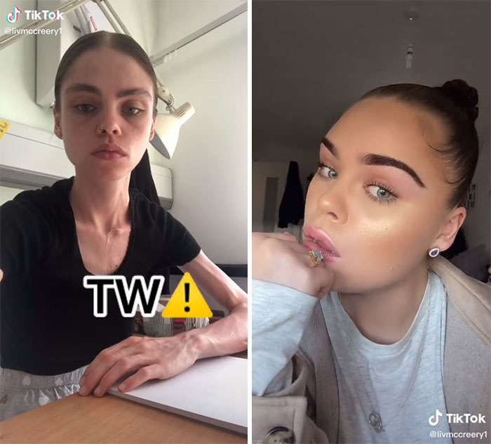 Before-After-Transformations-Tiktok-Not-The-Same-Anymore