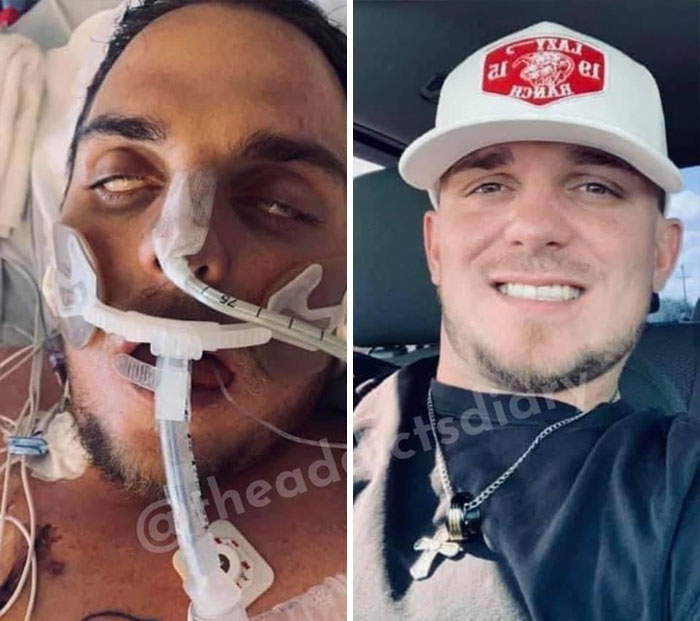 Before-After-Transformation-Stories-The-Addicts-Diary