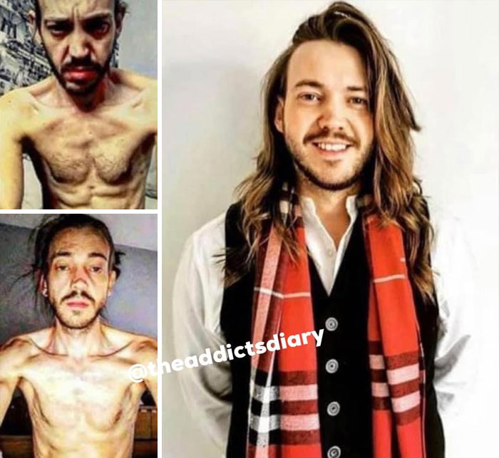 Before-After-Transformation-Stories-The-Addicts-Diary