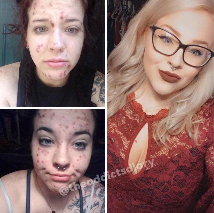 Before-After-Transformation-Stories-The-Addicts-Diary