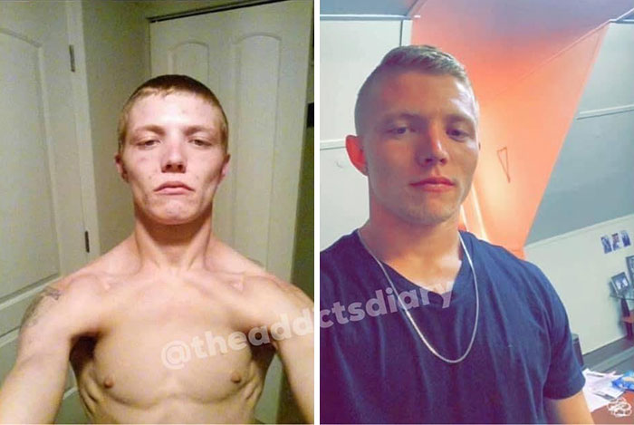 Before-After-Transformation-Stories-The-Addicts-Diary