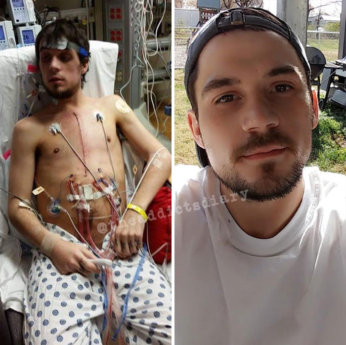 Before-After-Transformation-Stories-The-Addicts-Diary