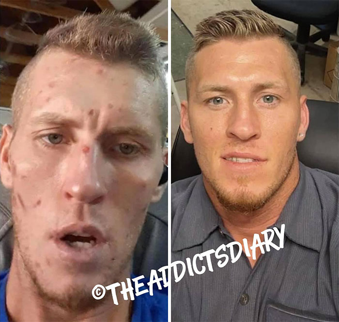 Before-After-Transformation-Stories-The-Addicts-Diary