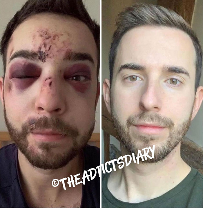 Before-After-Transformation-Stories-The-Addicts-Diary