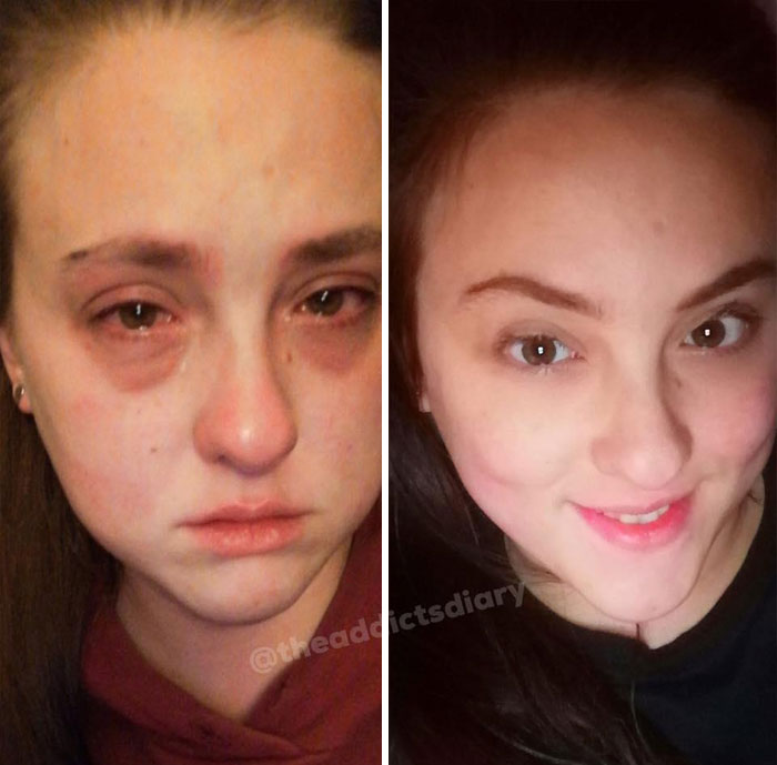 Before-After-Transformation-Stories-The-Addicts-Diary
