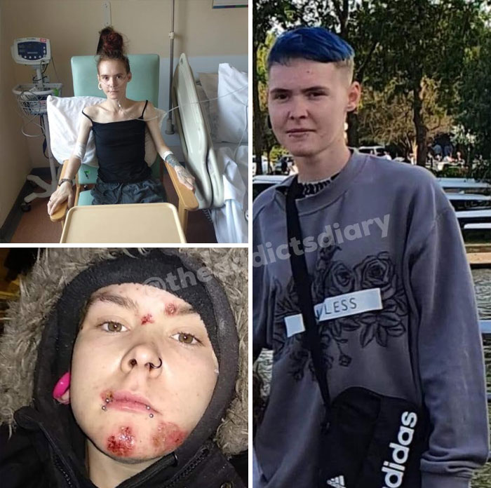 Before-After-Transformation-Stories-The-Addicts-Diary