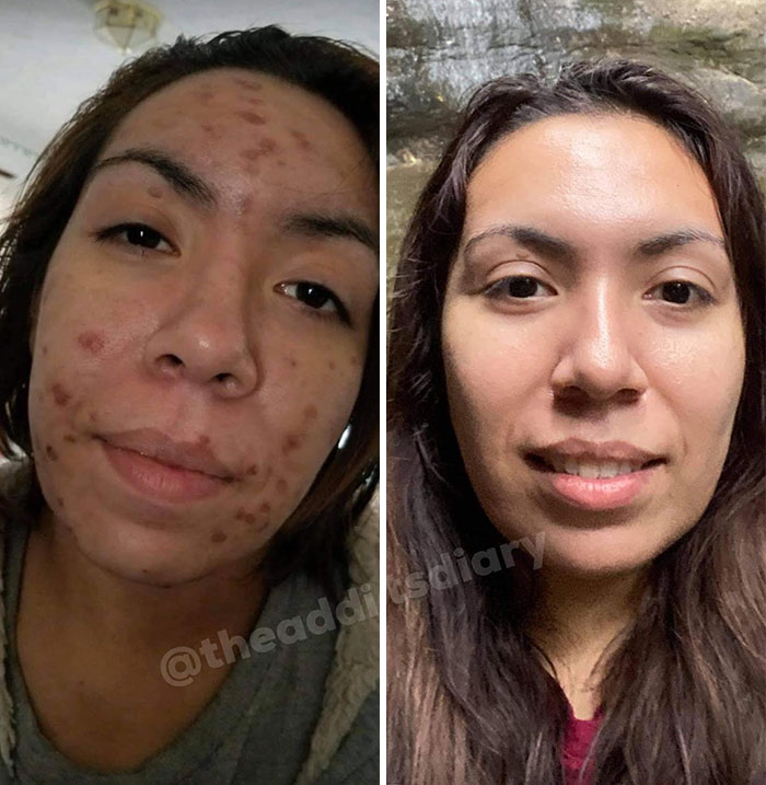 Before-After-Transformation-Stories-The-Addicts-Diary