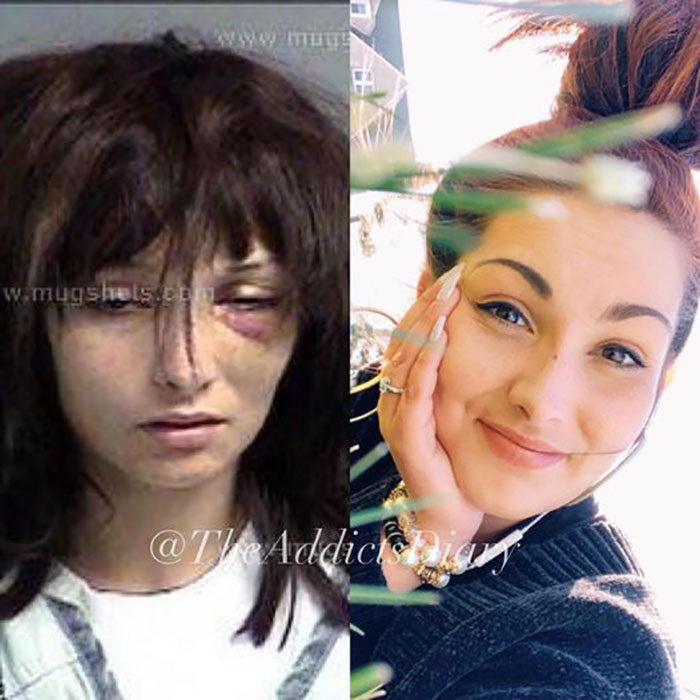 Before-After-Transformation-Stories-The-Addicts-Diary