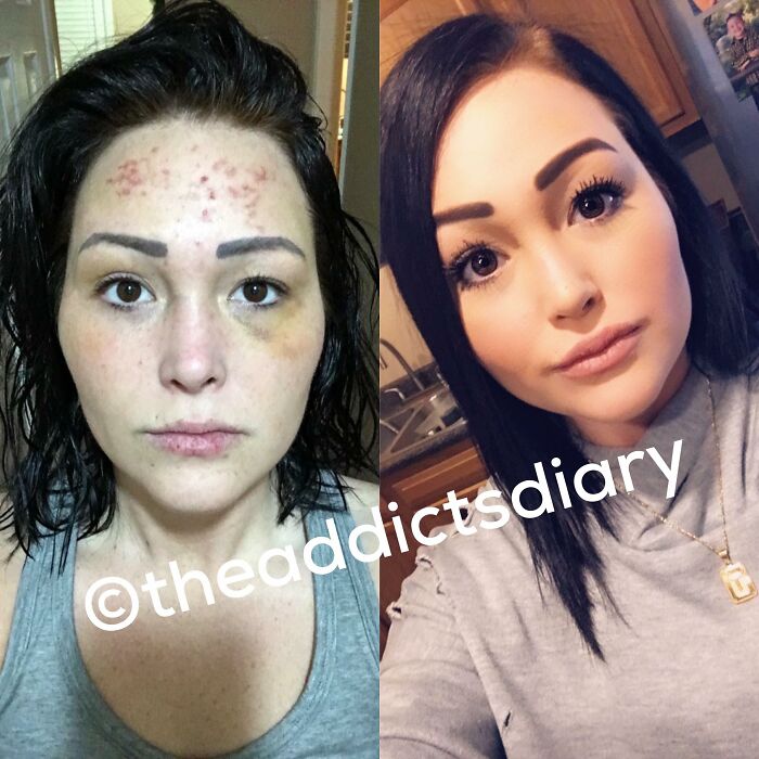 Before-After-Transformation-Stories-The-Addicts-Diary