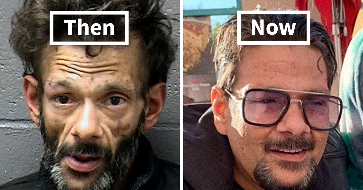 ‘The Addict’s Diary’ Showcases Before & After Transformations Of People Who Quit Drugs (30 Stories)