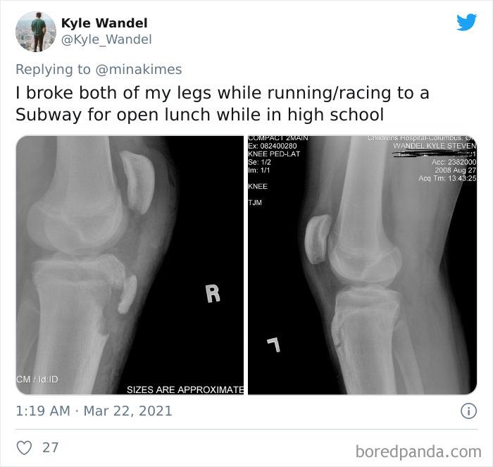 People-Share-Stupidest-Injury