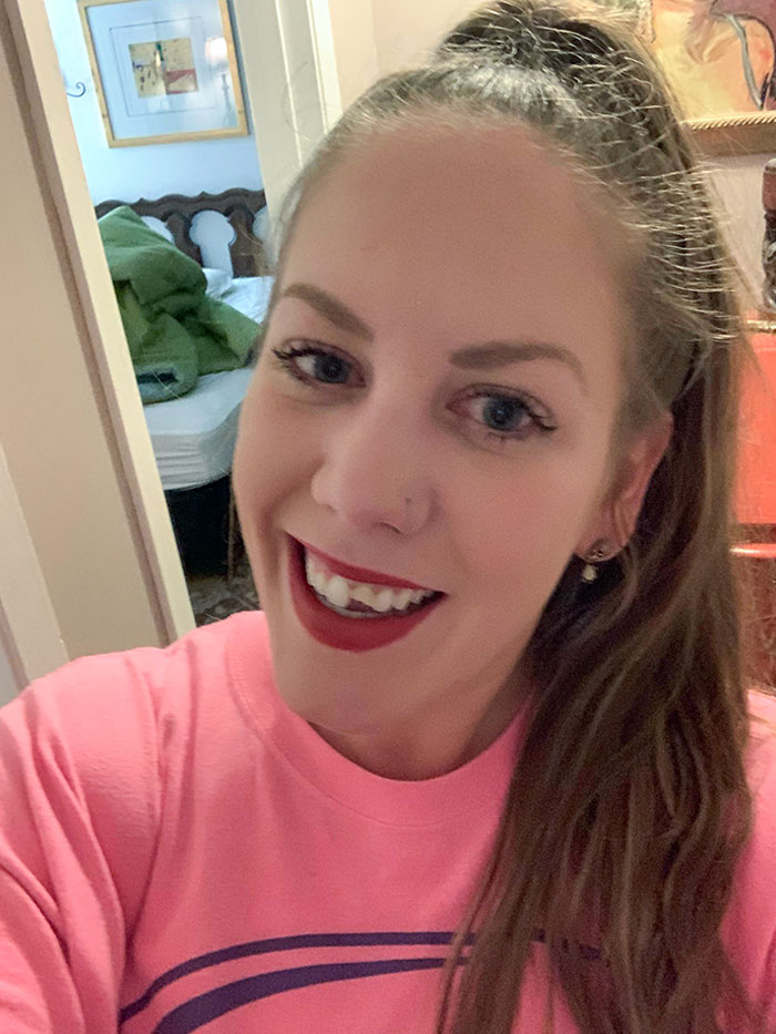 My 11-Month-Old Son Just Hit Me In The Face With His Toy And Broke My Tooth In Half