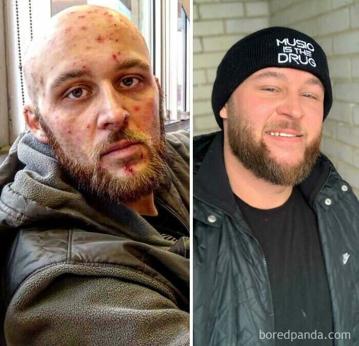 My Recovery From Addiction - My Name Is Hunter Michael Shepard And I Am An Addict In Long Term Recovery. If You’re Struggling Today Just Know There Is Hope. Put The Dope Down And F**king Crush Life. You’re Worth It