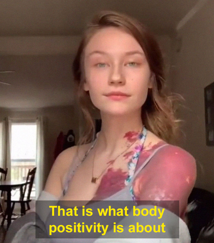 'There's Nothing Positive About This': Guy Explains How People Should Not Celebrate 'Plus Size' Bodies