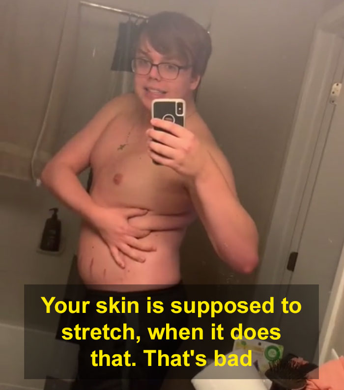 'There's Nothing Positive About This': Guy Explains How People Should Not Celebrate 'Plus Size' Bodies