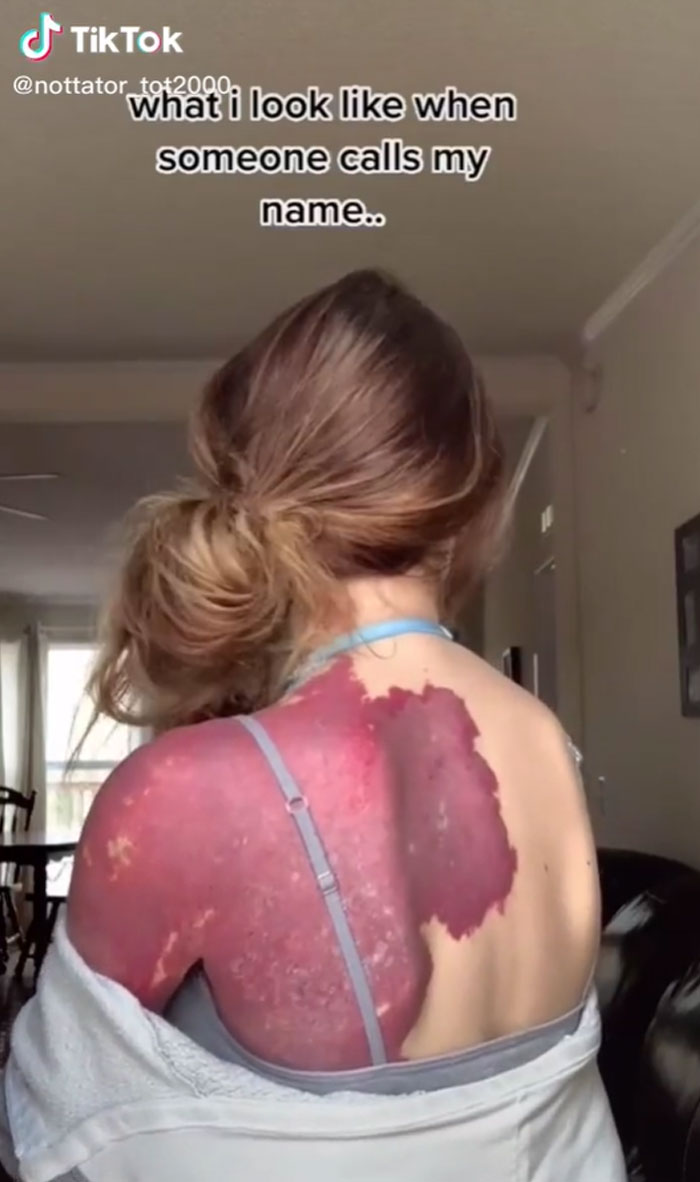 'There's Nothing Positive About This': Guy Explains How People Should Not Celebrate 'Plus Size' Bodies 'There's Nothing Positive About This': Guy Explains How People Should Not Celebrate 'Plus Size' Bodies