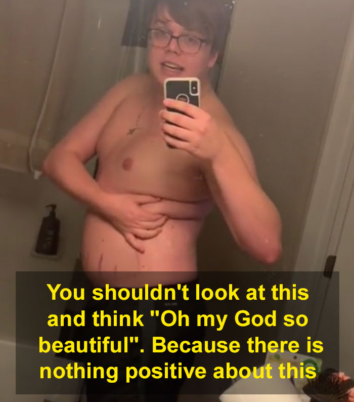 'There's Nothing Positive About This': Guy Explains How People Should Not Celebrate 'Plus Size' Bodies 'There's Nothing Positive About This': Guy Explains How People Should Not Celebrate 'Plus Size' Bodies