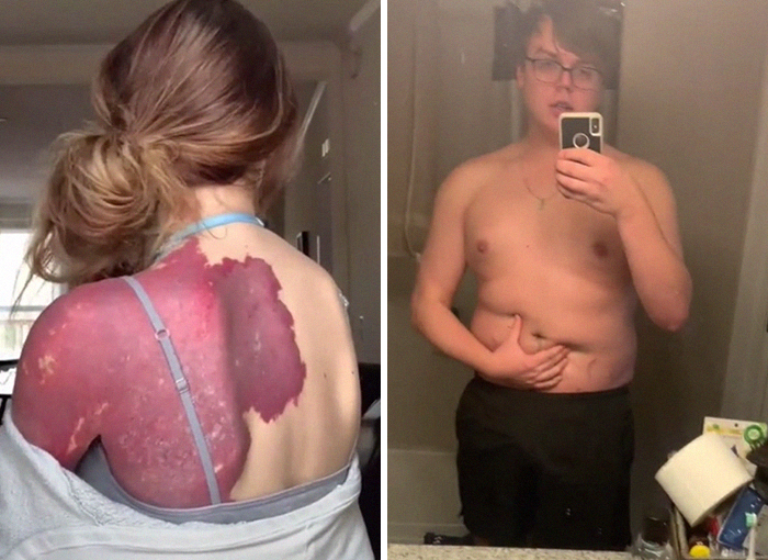 «No hay nada positivo en esto»: Este chico explica cómo la gente no debería celebrar los cuerpos de «talla grande»