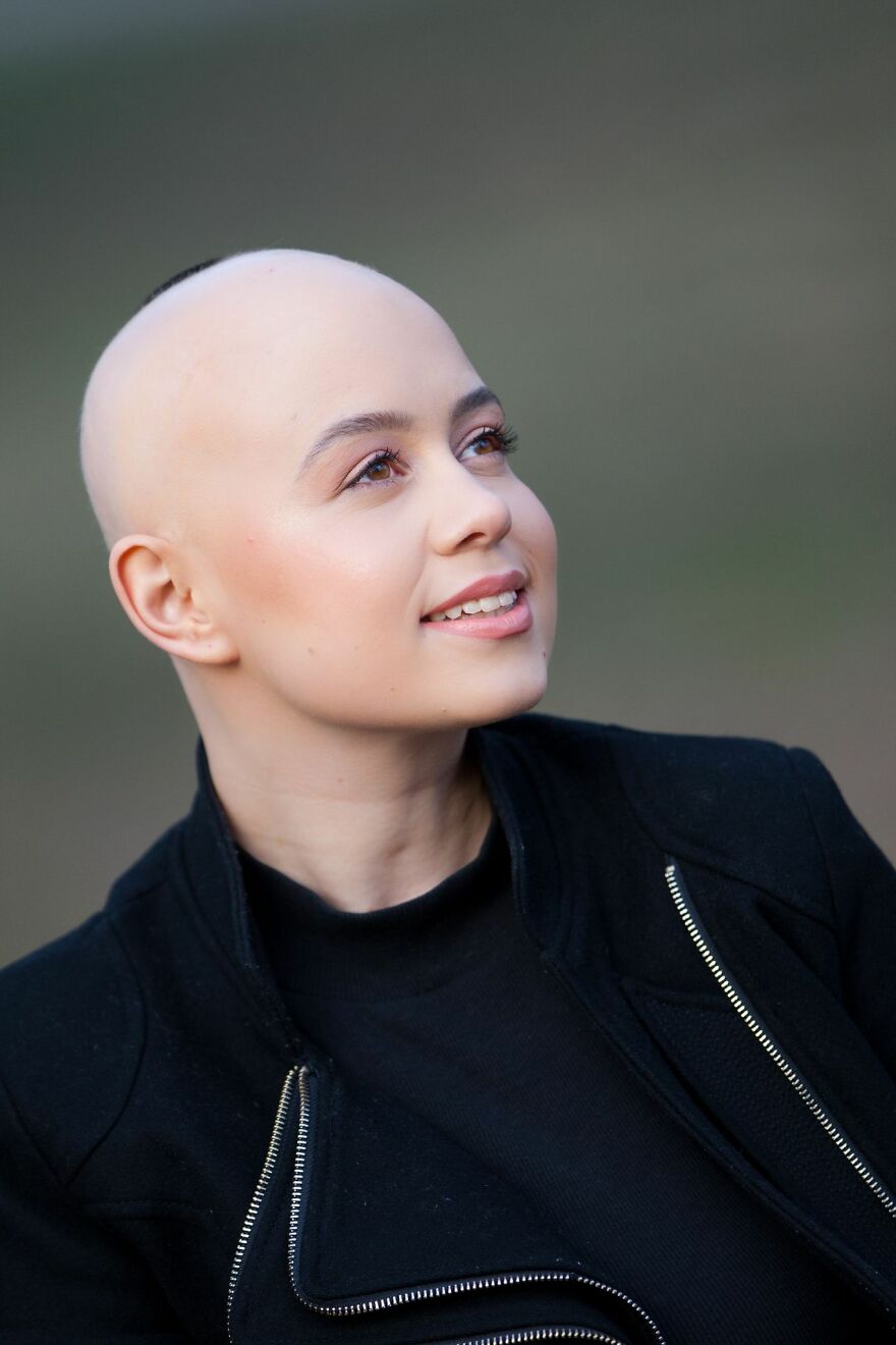 I Captured The Beautiful TV Reporter Who Decided To Embrace Her Alopecia I Captured The Beautiful TV Reporter Who Decided To Embrace Her Alopecia