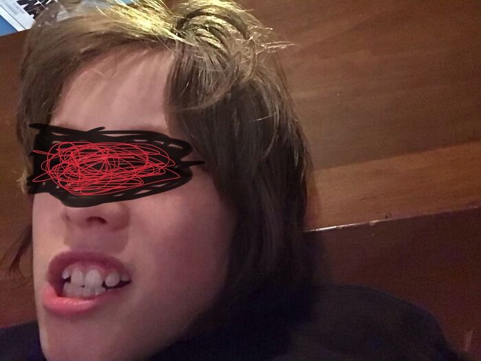 I Did You A Favor And Blacked Out The Eyes. So...much...acne. I Hate You Puberty