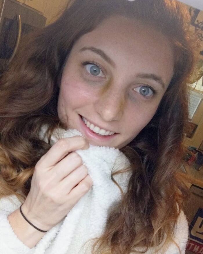 I Learned That You Should Be Able To Breathe Through Your Nose. I Underwent Sinus Surgery And Breathed A Real Breath Through My Nose For The First Time In 26 Years