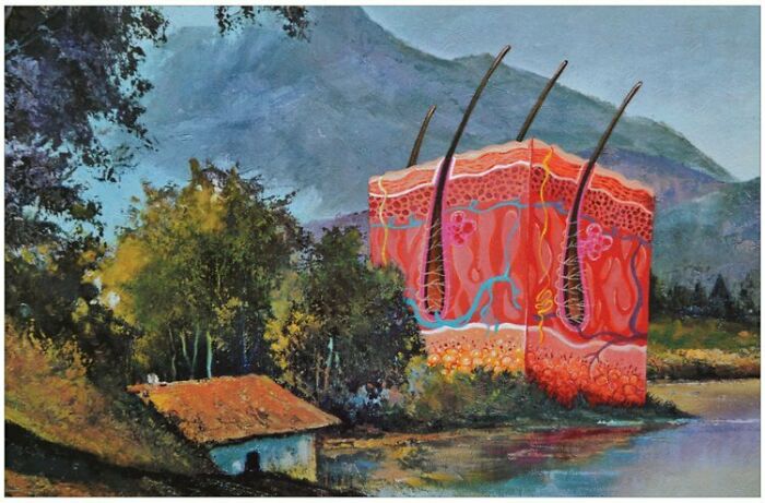 "Waterfront Property" ... Sometimes A Cross Section Of The Skin Needs To Be Painted