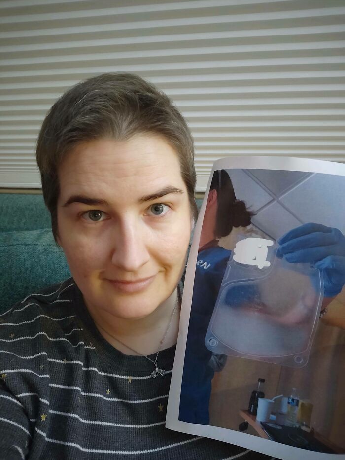 Remember Me? The White Blood Cell Immunotherapy Girl? Well, Update: It Worked. Stage 4 To No Cancer In 3 Months! Science Is Magic