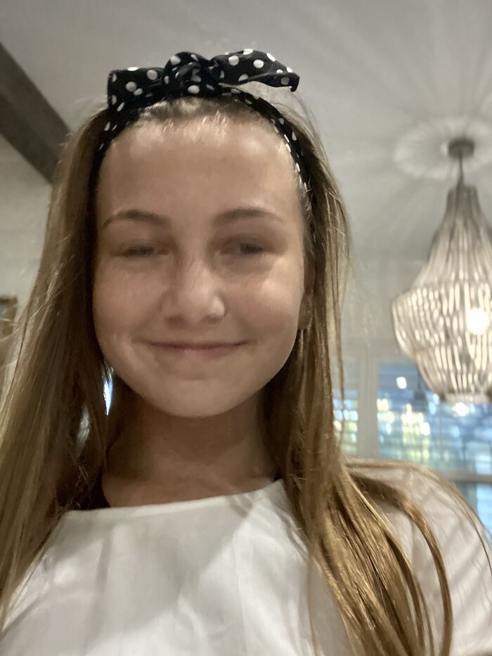 Mid-Blink Taking A Photo