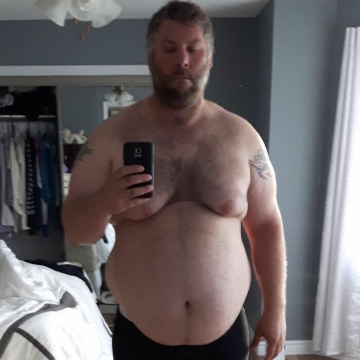 Guy Loses Half Of His Body Weight After Surviving A Near-Fatal Heart Attack And Looks Unrecognizable Guy Loses Half Of His Body Weight After Surviving A Near-Fatal Heart Attack And Looks Unrecognizable