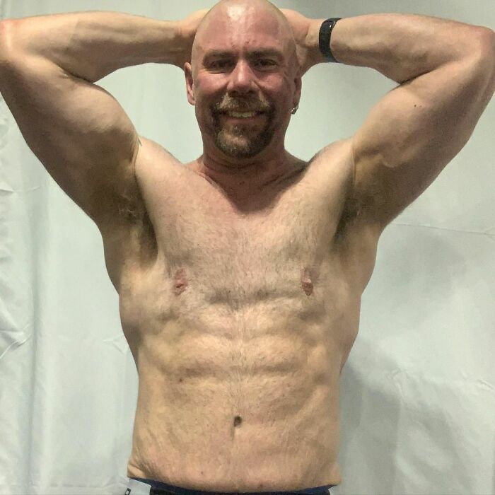 Guy Loses Half Of His Body Weight After Surviving A Near-Fatal Heart Attack And Looks Unrecognizable Guy Loses Half Of His Body Weight After Surviving A Near-Fatal Heart Attack And Looks Unrecognizable