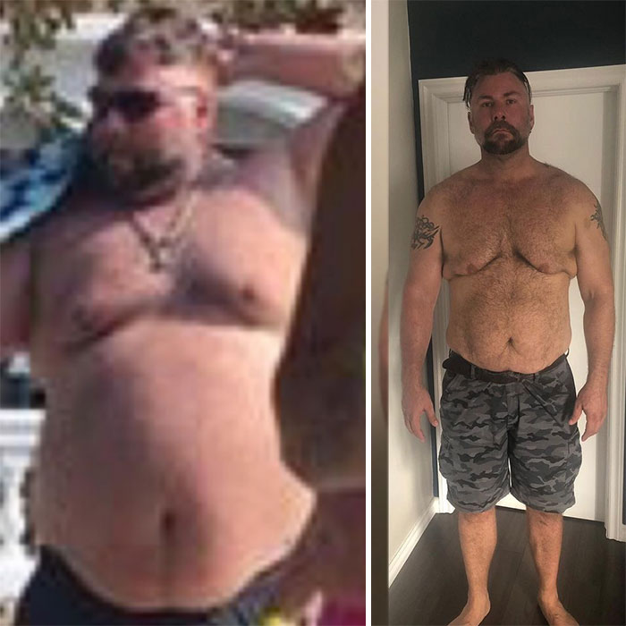 Guy Loses Half Of His Body Weight After Surviving A Near-Fatal Heart Attack And Looks Unrecognizable Guy Loses Half Of His Body Weight After Surviving A Near-Fatal Heart Attack And Looks Unrecognizable