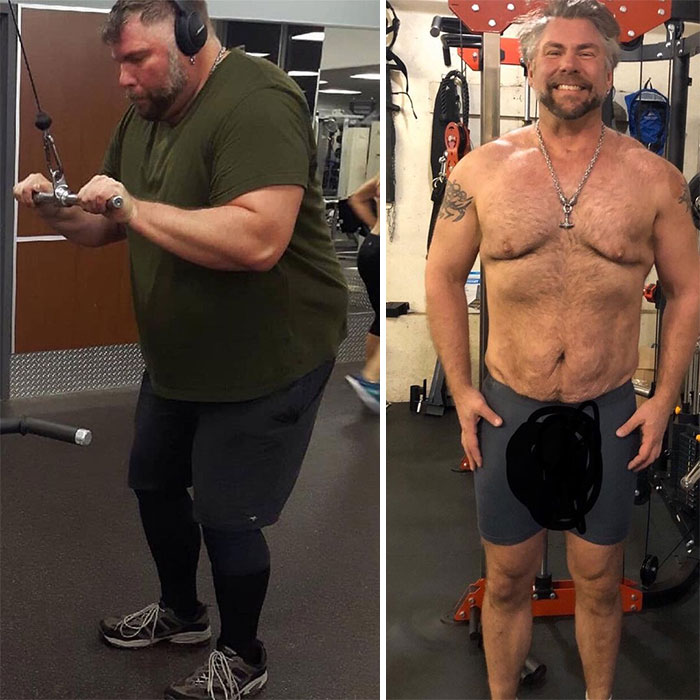 Guy Loses Half Of His Body Weight After Surviving A Near-Fatal Heart Attack And Looks Unrecognizable
