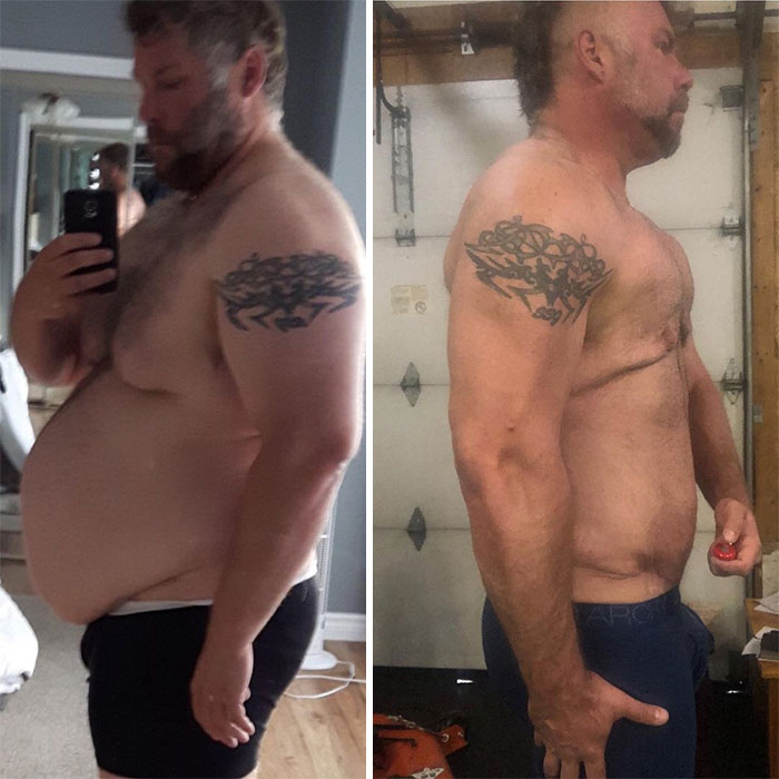 Guy Loses Half Of His Body Weight After Surviving A Near-Fatal Heart Attack And Looks Unrecognizable Guy Loses Half Of His Body Weight After Surviving A Near-Fatal Heart Attack And Looks Unrecognizable