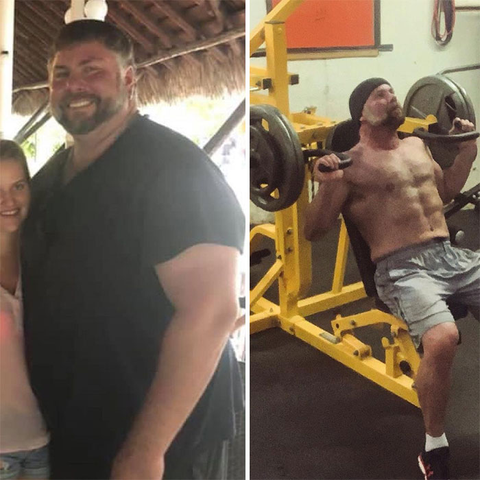 Guy Loses Half Of His Body Weight After Surviving A Near-Fatal Heart Attack And Looks Unrecognizable