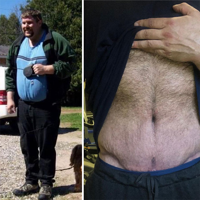 Guy Loses Half Of His Body Weight After Surviving A Near-Fatal Heart Attack And Looks Unrecognizable Guy Loses Half Of His Body Weight After Surviving A Near-Fatal Heart Attack And Looks Unrecognizable