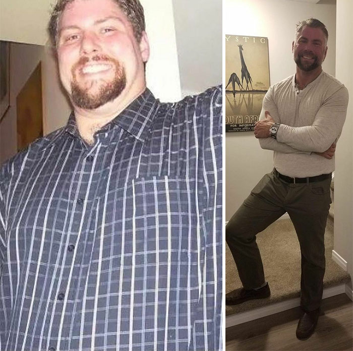 Guy Loses Half Of His Body Weight After Surviving A Near-Fatal Heart Attack And Looks Unrecognizable Guy Loses Half Of His Body Weight After Surviving A Near-Fatal Heart Attack And Looks Unrecognizable