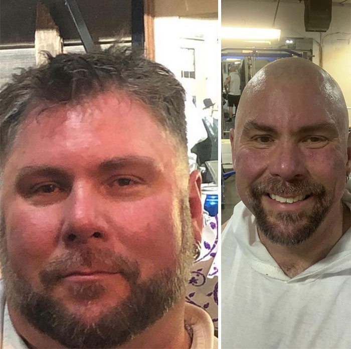 Guy Loses Half Of His Body Weight After Surviving A Near-Fatal Heart Attack And Looks Unrecognizable Guy Loses Half Of His Body Weight After Surviving A Near-Fatal Heart Attack And Looks Unrecognizable