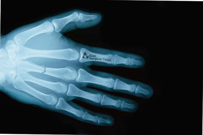 Designers Are Challenged To Place Ads, Logos Or Stores In The Most Unexpected Areas Imaginable