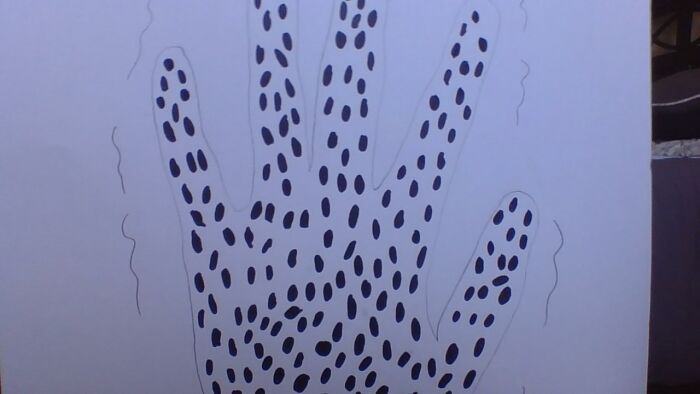 Trypophobia: Fear Of Tiny Holes/Bumps