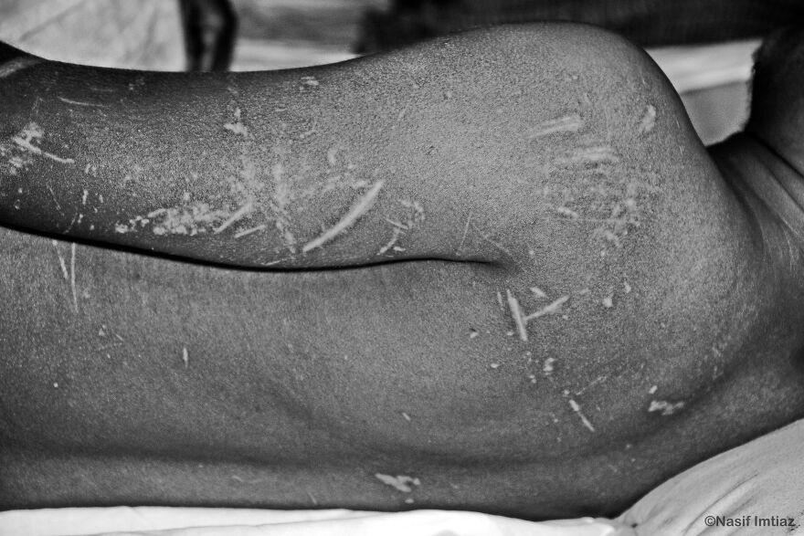 Can't Remember Anything