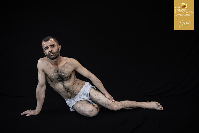 Open Wounds By Younes Mohammad. Gold In Editorial