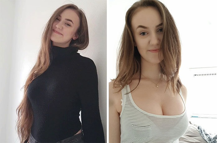 I Donated My Hair To A Charity For Girls With Alopecia